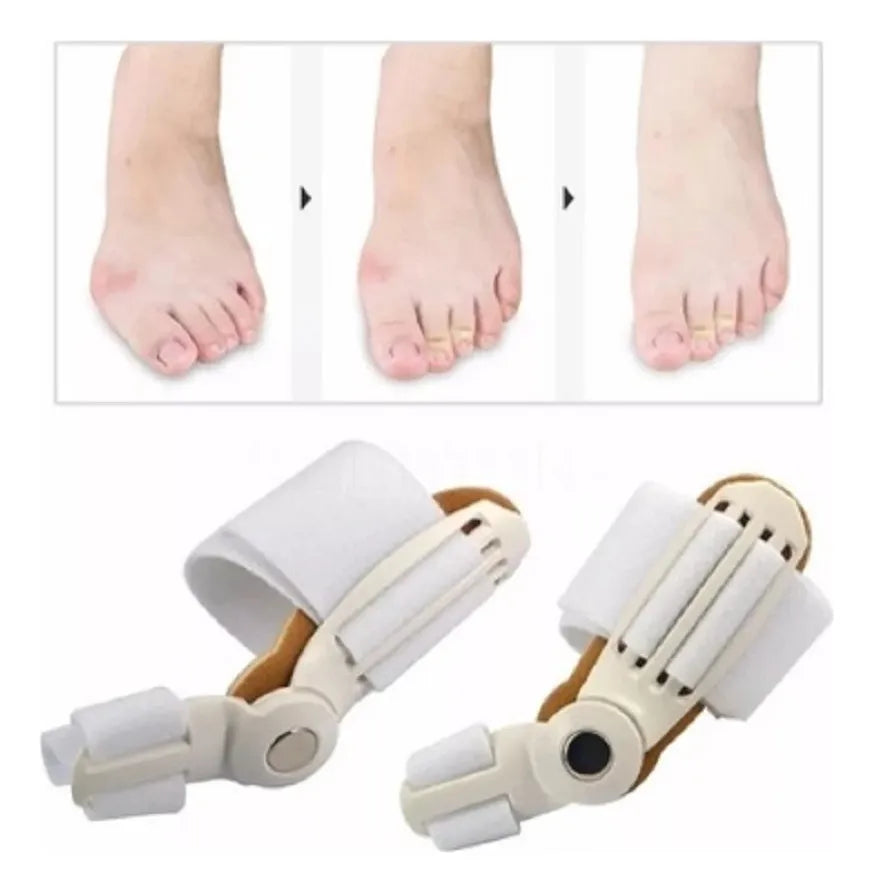 Corrector de Juanetes Premium – Alivio Inmediato y Confort Diario